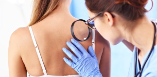 visita dermatologica e prevenzione del melanoma